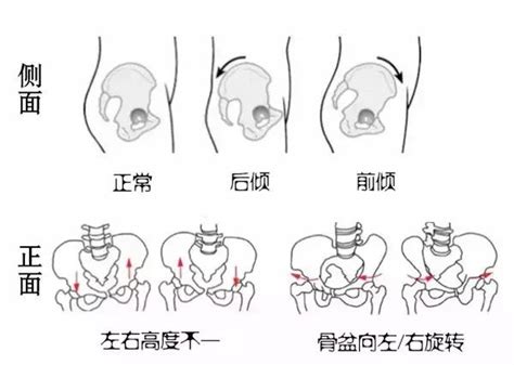 歪斜的意思